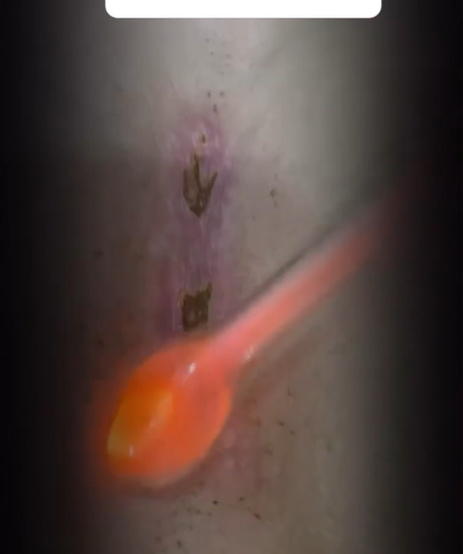 Healing wounds and skin inflammation
